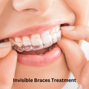 Invisible Braces Treatment