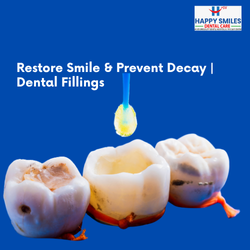 Dental Fillings
