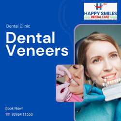 dental veneers