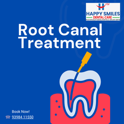 Dentist in vasthalipuram root canal