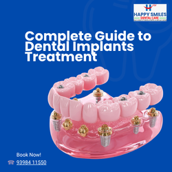 Dental Implants Treatment